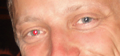 Red eye removed